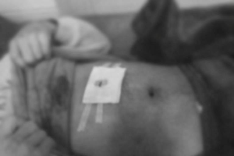 စစ်ကောင်စီရွေးကောက်ပွဲကာလ ဖားကန့်တွင် လက်နက်ကြီးကျရောက်ပေါက်ကွဲမှုကြောင့် အရပ်သား (၅) ဦး ထိခိုက်