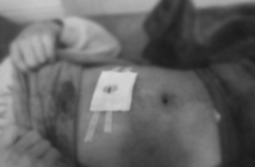 စစ်ကောင်စီရွေးကောက်ပွဲကာလ ဖားကန့်တွင် လက်နက်ကြီးကျရောက်ပေါက်ကွဲမှုကြောင့် အရပ်သား (၅) ဦး ထိခိုက်